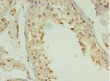 ACBD4 Antibody - Immunohistochemistry of paraffin-embedded human testis tissue using antibody at 1:100 dilution.  This image was taken for the unconjugated form of this product. Other forms have not been tested.