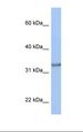 ACBD4 Antibody - MCF7 cell lysate. Antibody concentration: 1.0 ug/ml. Gel concentration: 12%.  This image was taken for the unconjugated form of this product. Other forms have not been tested.