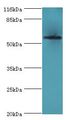 ACBD5 Antibody - Western blot. All lanes: ACBD5 antibody at 2 ug/ml+HeLa whole cell lysate. Secondary antibody: Goat polyclonal to rabbit at 1:10000 dilution. Predicted band size: 60 kDa. Observed band size: 60 kDa.  This image was taken for the unconjugated form of this product. Other forms have not been tested.