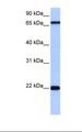 ACCSL Antibody - Jurkat cell lysate. Antibody concentration: 0.5 ug/ml. Gel concentration: 12%.  This image was taken for the unconjugated form of this product. Other forms have not been tested.