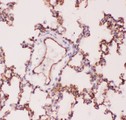 ACE / CD143 Antibody - ACE antibody IHC-paraffin: Rat Lung Tissue.
