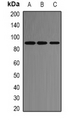 ACE2 / ACE-2 Antibody - Western blot analysis of ACE2 expression in HeLa (A); SP20 (B); PC12 (C) whole cell lysates.