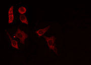 ACER1 / ASAH3 Antibody - Staining HepG2 cells by IF/ICC. The samples were fixed with PFA and permeabilized in 0.1% Triton X-100, then blocked in 10% serum for 45 min at 25°C. The primary antibody was diluted at 1:200 and incubated with the sample for 1 hour at 37°C. An Alexa Fluor 594 conjugated goat anti-rabbit IgG (H+L) antibody, diluted at 1/600, was used as secondary antibody.