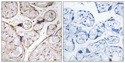 ACER3 Antibody - Immunohistochemistry analysis of paraffin-embedded human placenta tissue, using PHCA Antibody. The picture on the right is blocked with the synthesized peptide.
