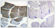 Acetyl-CoA Carboxylase / ACC Antibody - Immunohistochemistry analysis of paraffin-embedded human skeletal muscle tissue, using ACC1 Antibody. The picture on the right is blocked with the synthesized peptide.