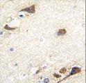 ACHE / Acetylcholinesterase Antibody - Formalin-fixed and paraffin-embedded human brain tissue reacted with ACHE antibody , which was peroxidase-conjugated to the secondary antibody, followed by DAB staining. This data demonstrates the use of this antibody for immunohistochemistry; clinical relevance has not been evaluated.