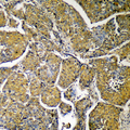 ACLY / ATP Citrate Lyase Antibody - Immunohistochemical analysis of ACLY staining in human liver formalin fixed paraffin embedded tissue section. The section was pre-treated using heat mediated antigen retrieval with sodium citrate buffer (pH 6.0). The section was then incubated with the antibody at room temperature and detected using an HRP conjugated compact polymer system. DAB was used as the chromogen. The section was then counterstained with hematoxylin and mounted with DPX.