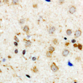 ACO1 / Aconitase Antibody - Immunohistochemical analysis of Aconitase 1 (pS711) staining in human brain formalin fixed paraffin embedded tissue section. The section was pre-treated using heat mediated antigen retrieval with sodium citrate buffer (pH 6.0). The section was then incubated with the antibody at room temperature and detected using an HRP conjugated compact polymer system. DAB was used as the chromogen. The section was then counterstained with hematoxylin and mounted with DPX.