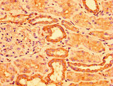 ACOT1 Antibody - Immunohistochemistry image at a dilution of 1:300 and staining in paraffin-embedded human kidney tissue performed on a Leica BondTM system. After dewaxing and hydration, antigen retrieval was mediated by high pressure in a citrate buffer (pH 6.0) . Section was blocked with 10% normal goat serum 30min at RT. Then primary antibody (1% BSA) was incubated at 4 °C overnight. The primary is detected by a biotinylated secondary antibody and visualized using an HRP conjugated SP system.