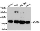 ACOT8 Antibody - Western blot analysis of extracts of various cell lines, using ACOT8 antibody at 1:3000 dilution. The secondary antibody used was an HRP Goat Anti-Rabbit IgG (H+L) at 1:10000 dilution. Lysates were loaded 25ug per lane and 3% nonfat dry milk in TBST was used for blocking. An ECL Kit was used for detection and the exposure time was 30s.