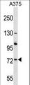 ACOX2 Antibody - ACOX2 Antibody western blot of A375 cell line lysates (35 ug/lane). The ACOX2 antibody detected the ACOX2 protein (arrow).