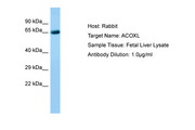 ACOXL Antibody -  This image was taken for the unconjugated form of this product. Other forms have not been tested.
