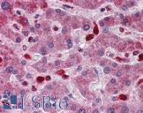 ACP2 / Acid Phosphatase 2 Antibody - Anti-ACP2 / Acid Phosphatase 2 antibody IHC of human liver. Immunohistochemistry of formalin-fixed, paraffin-embedded tissue after heat-induced antigen retrieval. Antibody concentration 5 ug/ml.  This image was taken for the unconjugated form of this product. Other forms have not been tested.