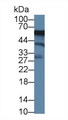 ACP6 Antibody - Western Blot; Sample: Human K562 cell lysate; Primary Ab: 1µg/ml Rabbit Anti-Mouse ACP6 Antibody Second Ab: 0.2µg/mL HRP-Linked Caprine Anti-Rabbit IgG Polyclonal Antibody