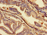 ACP6 Antibody - Immunohistochemistry image of paraffin-embedded human prostate tissue at a dilution of 1:100