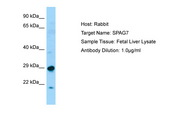 ACRP / SPAG7 Antibody -  This image was taken for the unconjugated form of this product. Other forms have not been tested.