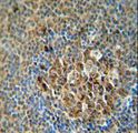 ACSF3 Antibody - ACSF3 antibody immunohistochemistry of formalin-fixed and paraffin-embedded human tonsils tissue followed by peroxidase-conjugated secondary antibody and DAB staining.