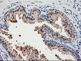 ACSS2 / ACAS2 Antibody - IHC of paraffin-embedded Human prostate tissue using anti-ACSS2 mouse monoclonal antibody.