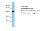 ACTBL2 Antibody -  This image was taken for the unconjugated form of this product. Other forms have not been tested.