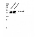 ACTG2 Antibody - Western blot of Actin alpha3 antibody