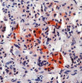 ACTH Antibody - Formalin-fixed, paraffin-embedded human pituitary gland stained with peroxidase-conjugate and AEC chromogen. Note cytoplasmic staining of anterior pituitary cells.  This image was taken for the unmodified form of this product. Other forms have not been tested.
