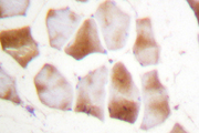 Actin, Alpha+Gamma Antibody - IHC of Actin-/ (Q49) pAb in paraffin-embedded human skeletal muscle tissue.