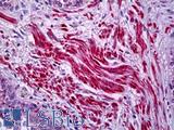 Actin Antibody - Human Prostate, Smooth Muscle: Formalin-Fixed, Paraffin-Embedded (FFPE)