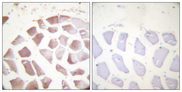 Actin Antibody - Immunohistochemistry analysis of paraffin-embedded human skeletal muscle, using Actin-pan (alpha/gamma) (Phospho-Tyr55/53) Antibody. The picture on the right is blocked with the phospho peptide.