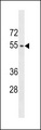 ACTL9 Antibody - ACTL9 Antibody western blot of A2058 cell line lysates (35 ug/lane). The ACTL9 antibody detected the ACTL9 protein (arrow).