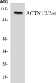 ACTN1+2+3+4 Antibody - Western blot analysis of the lysates from COLO205 cells using ACTN1/2/3/4 antibody.