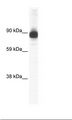 ACTN2 Antibody - Muscle Lysate.  This image was taken for the unconjugated form of this product. Other forms have not been tested.