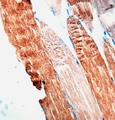 ACTN2 Antibody - Formalin-fixed, paraffin-embedded human skeletal muscle stained with Actin, Sarcomeric antibody.