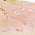 ACTN2 Antibody - Immunohistochemical analysis of ACTN2 staining in human muscle formalin fixed paraffin embedded tissue section. The section was pre-treated using heat mediated antigen retrieval with sodium citrate buffer (pH 6.0). The section was then incubated with the antibody at room temperature and detected using an HRP conjugated compact polymer system. DAB was used as the chromogen. The section was then counterstained with hematoxylin and mounted with DPX.