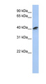 ACTR1A / Centractin Antibody - ACTR1A antibody Western blot of MCF7 cell lysate. This image was taken for the unconjugated form of this product. Other forms have not been tested.