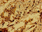 ACTR1A / Centractin Antibody - Immunohistochemistry of paraffin-embedded human pancreatic cancer at dilution of 1:100