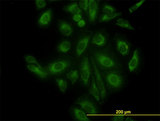 ACTR3 Antibody - Immunofluorescence of monoclonal antibody to ACTR3 on HeLa cell. [antibody concentration 10 ug/ml]