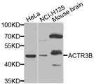 ACTR3B / ARP4 Antibody - Western blot analysis of extracts of various cell lines.