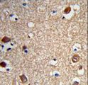ACTR5 / ARP5 Antibody - Formalin-fixed and paraffin-embedded human brain tissue reacted with ACTR5 Antibody , which was peroxidase-conjugated to the secondary antibody, followed by DAB staining. This data demonstrates the use of this antibody for immunohistochemistry; clinical relevance has not been evaluated.