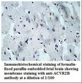 ACTRIIB / ACVR2B Antibody
