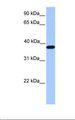 ACTRT2 Antibody - Fetal muscle lysate. Antibody concentration: 1.0 ug/ml. Gel concentration: 12%.  This image was taken for the unconjugated form of this product. Other forms have not been tested.