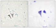 ACVR1C / ALK7 Antibody - Immunohistochemistry analysis of paraffin-embedded human brain tissue, using ACTR-1C Antibody. The picture on the right is blocked with the synthesized peptide.
