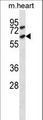 ACVR1C / ALK7 Antibody - Mouse Acvr1c Antibody western blot of mouse heart tissue lysates (35 ug/lane). The Acvr1c antibody detected the Acvr1c protein (arrow).