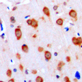 ACVRL1 Antibody - Immunohistochemical analysis of ALK1 staining in human brain formalin fixed paraffin embedded tissue section. The section was pre-treated using heat mediated antigen retrieval with sodium citrate buffer (pH 6.0). The section was then incubated with the antibody at room temperature and detected using an HRP conjugated compact polymer system. DAB was used as the chromogen. The section was then counterstained with hematoxylin and mounted with DPX.