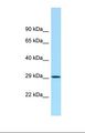 ACY3 Antibody - Western blot of Human U937. HCBP1 antibody dilution 1.0 ug/ml.  This image was taken for the unconjugated form of this product. Other forms have not been tested.