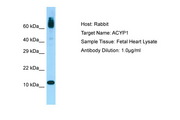 ACYP1 Antibody -  This image was taken for the unconjugated form of this product. Other forms have not been tested.