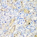 ADAD1 Antibody - Immunohistochemistry of paraffin-embedded mouse kidney tissue.