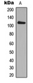 ADAM19 Antibody - Western blot analysis of ADAM19 expression in MCF7 (A) whole cell lysates.
