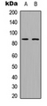 ADAM28 Antibody - Western blot analysis of ADAM28 expression in A549 (A); Raw264.7 (B) whole cell lysates.
