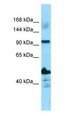 ADAMTS14 Antibody - ADAMTS14 antibody Western Blot of OVCAR-3.  This image was taken for the unconjugated form of this product. Other forms have not been tested.