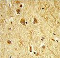 ADAMTS18 Antibody - Formalin-fixed and paraffin-embedded human brain tissue reacted with ADAMTS18 Antibody , which was peroxidase-conjugated to the secondary antibody, followed by DAB staining. This data demonstrates the use of this antibody for immunohistochemistry; clinical relevance has not been evaluated.